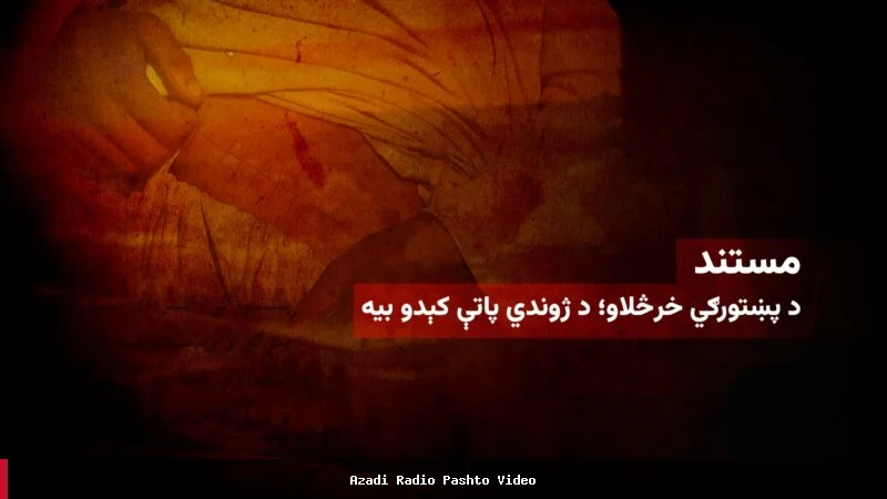 فروش کلیه در افغانستان؛ راهی برای بقا در شرایط دشوار اقتصادی